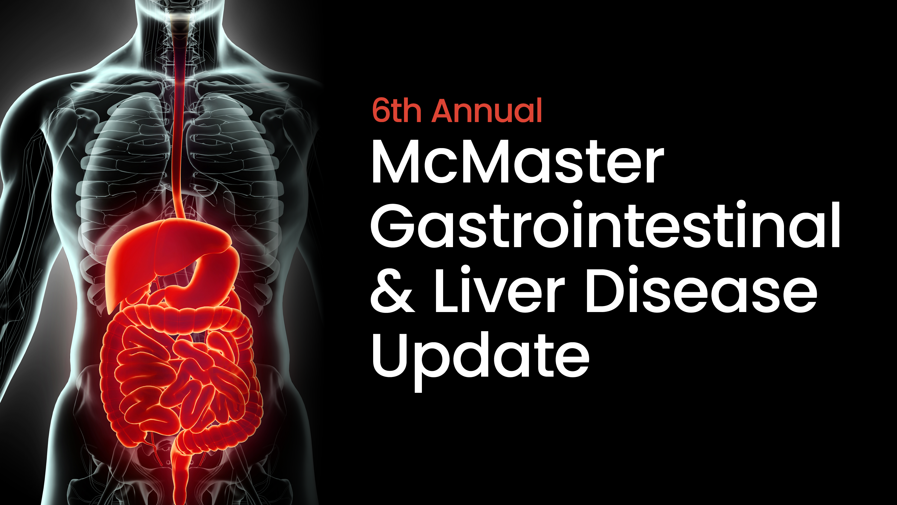 6th Annual McMaster Gastrointestinal and Liver Disease Update